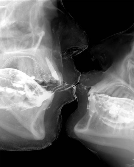 vous avez déjà vu un baiser, mais un baiser au rayon X ?